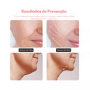 Massageador Facial Anti-Rugas e Flacidez com LED – USB Bivolt