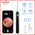 Endoscópio Visual Sem Fio TONGWODE – Removedor de Cera com Colher de Silicone, Câmera 5MP, Otoscopia Iluminado 3,9mm, Bateria 240mAh