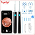 Endoscópio Visual Sem Fio TONGWODE – Removedor de Cera com Colher de Silicone, Câmera 5MP, Otoscopia Iluminado 3,9mm, Bateria 240mAh
