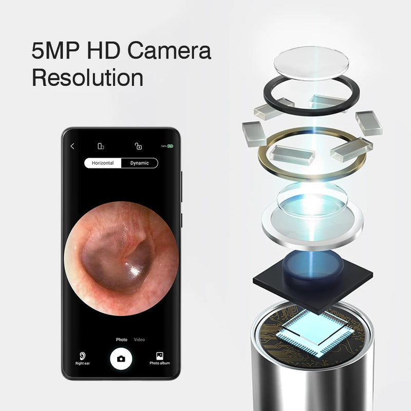 Endoscópio Visual Sem Fio TONGWODE – Removedor de Cera com Colher de Silicone, Câmera 5MP, Otoscopia Iluminado 3,9mm, Bateria 240mAh