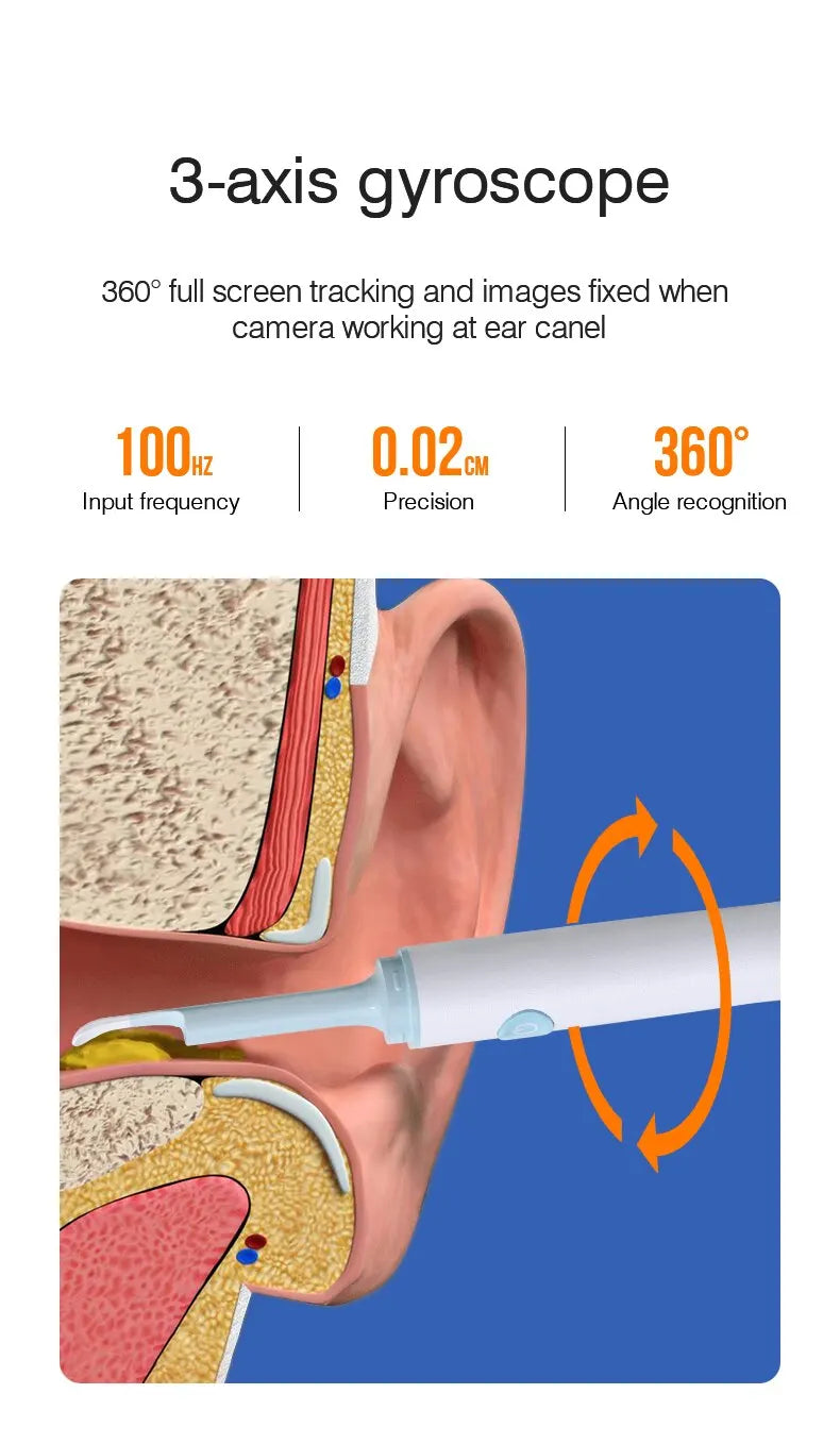 Endoscópio Visual Sem Fio TONGWODE – Removedor de Cera com Colher de Silicone, Câmera 5MP, Otoscopia Iluminado 3,9mm, Bateria 240mAh