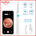 Endoscópio Visual Sem Fio TONGWODE – Removedor de Cera com Colher de Silicone, Câmera 5MP, Otoscopia Iluminado 3,9mm, Bateria 240mAh